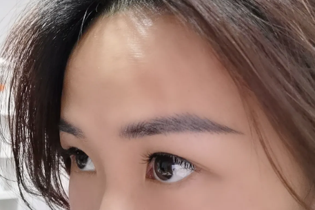 慢性荨麻疹长期反复发作找不到明确过敏原，该怎么排查潜在的深层病因？